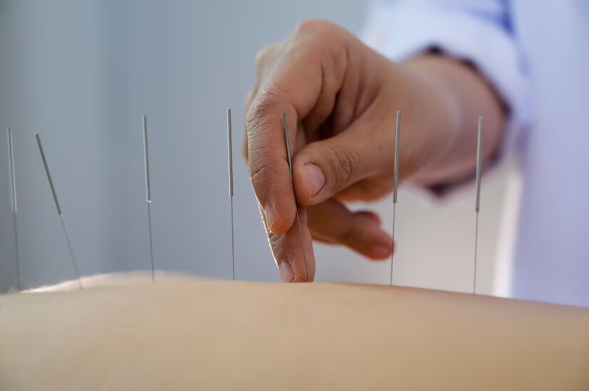 acupuncture-women-who-are-back-acupuncture-treatment-salon_35534-618.jpg acupuncture-women-who-are-back-acupuncture-treatment-salon_35534-618.jpg